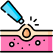 Acne Treatment